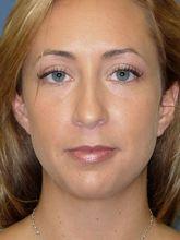 Plastic Surgery Annapolis on Md   Plastic Surgery Specialists  Board Certified Plastic Surgeons